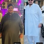 A person after bariatric surgery done by Dr. Amjid Saeed Mian, the best laparoscopic surgeon in Lahore.